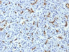 IHC testing of FFPE human pancreas with CFTR antibody (clone CFTR/1643) . HIER: boil tissue sections in 10mM Tris with 1mM EDTA, pH9 for 10-20 min followed by cooling at RT for 20 min.