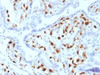 IHC testing of FFPE human placenta with Factor XIIIa antibody (clone SPM180) . Required HIER: boil tissue sections in 10mM citrate buffer, pH 6, for 10-20 min.