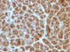 IHC testing of FFPE human pancreas with Elastase 3B antibody (clone CELA3B/1257) . Required HIER: boil tissue sections in 10mM Tris with 1mM EDTA, pH 9, for 10-20 min followed by cooling at RT for 20 min.
