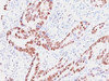 IHC testing of human colon with Retinoblastoma antibody (clone SPM353) . Required HIER: boil tissue sections in 10mM citrate buffer, pH 6, for 10-20 min followed by cooling at RT for 20 min.