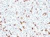 IHC testing of FFPE human pancreas with CFTR antibody (clone CFTR/1785) . HIER: boil tissue sections in 10mM Tris with 1mM EDTA, pH9 for 10-20 min followed by cooling at RT for 20 min.