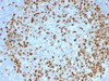 IHC testing of FFPE human tonsil with TOP2A antibody (clone TOP2A/1362) . Required HIER: boil sections in 10mM citrate buffer, pH6, for 10-20 min followed by cooling at RT for 20 min.