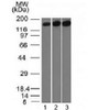 Western blot testing of 1) human HepG2, 2) HeLa and 3) mouse NIH3T3 cell lysate with Topoisomerase II alpha antibody (clone TOP2A/1361) . Expected molecular weight ~174 kDa.