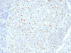 IHC testing of FFPE human tonsil tissue with Bcl6 antibody (clone BCL6/1526) . Required HIER: boil tissue sections in 10mM Tris with 1mM EDTA, pH 9, for 10-20 min.