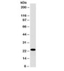 Western blot testing of human Jurkat cell lysate with CD3e antibody (clone PC3/188A) . Expected molecular weight ~23 kDa.