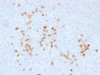 IHC testing of human tonsil and IgG antibody. Required HIER: boil tissue sections in 10mM citrate buffer, pH 6, for 10-20 min followed by cooling at RT for 20 min.