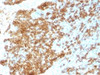 IHC testing of recombinant CD45RB antibody and FFPE human tonsil (clone PTPRC/1783R) . Required HIER: boil tissue sections in 10mM citrate buffer, pH 6, for 10-20 min followed by cooling at RT for 20 min.