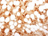 IHC testing of FFPE human bone marrow with CD71 / Transferrin Receptor antibody (clone TFRC/1818) . Required HIER: boil tissue sections in 10mM Tris with 1mM EDTA, pH 9, for 10-20 min followed by cooling at RT for 20 min.