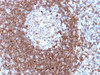 IHC testing of FFPE human tonsil with CD79a antibody. Required HIER: boil tissue sections in 10mM citrate buffer, pH 6, for 10-20 min followed by cooling at RT for 20 min.
