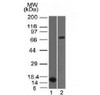 Western blot testing of 1) partial recombinant protein and 2) human HepG2 lysate with Bcl6 antibody (clone BCL6/1475) . Expected molecular weight: 78/95kDa (non-phosphorylated/phosphorylated) .