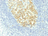 IHC testing of FFPE human tonsil with MCM7 antibody (clone MCM7/1467) . Required HIER: boil tissue sections in 10mM citrate buffer, pH 6, for 10-20 min.