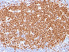 IHC testing of FFPE human tonsil with MCM7 antibody (clone MCM7/1468) . Required HIER: boil tissue sections in 10mM citrate buffer, pH 6, for 10-20 min.