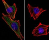 (Left) Confocal Immunofluorescent analysis of A2058 cells using AF488-labeled S100 beta antibody (green) . F-actin filaments were labeled with DyLight 554 Phalloidin (red) . DAPI was used to stain the cell nuclei (blue) . (Right) Negative control.