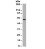 Western blot testing of HeLa cell lysate (nuclear fraction) with c-Myc antibody (clone MVH39-1) . Expected molecular weight: 50~70kDa.