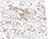 IHC testing of FFPE human kidney transplant tissue stained with C4d antibody (CPT4d-1) .