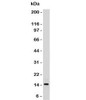 Western blot testing of HeLa lysate with SUMO2/3 antibody.