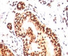 IHC analysis of human tonsil with SUMO2/3 antibody (clone S23MT-1) .