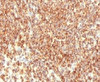 IHC testing of CD20 antibody and human lymphoma tissue