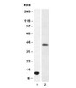 Western blot testing of 1) partial recombinant ARG1 protein and 2) human liver lysate using Arginase 1 antibody.