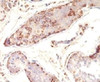 Formalin-fixed, paraffin-embedded human testicular carcinoma stained with MAGE-1 antibody (MZ2E/838) .