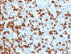 IHC testing of FFPE human tonsil with PD-1 antibody.