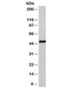 Western blot testing of human HeLa cell lysate with NSE antibody (clone NSEL1-1) . Predicted molecular weight ~47 kDa.