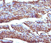 Formalin-fixed, paraffin-embedded human uterus stained with Calponin antibody (RMCN1-1) .