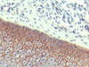 IHC testing of FFPE human skin with E-Cadherin antibody at 1ug/ml. HIER: steam sections in pH6 citrate buffer for 20 min.