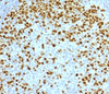 IHC testing of FFPE human tonsil with Topoisomerase II alpha antibody (clone TPM2A-2) .