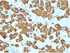 IHC testing of FFPE human pituitary gland with Growth Hormone antibody (clone GRHP1-1) . Required HIER: boil tissue sections in 10mM citrate buffer, pH 6, for 10-20 min.