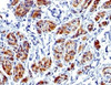 IHC testing of FFPE human uterus with recombinant Caldesmon antibody (clone CALD1/1424R) . Required HIER: boil tissue sections in 1mM EDTA, pH 7.5-8.5, for 10-20 min.