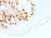 IHC testing FFPE human skin with recombinant Melan-A antibody (clone MLANA/1761R) . HIER: steam sections in 10mM citrate buffer, pH 6.0, for 10-20 min.