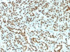 IHC testing of FFPE human pancreas and recombinant Histone H1 antibody (clone HH1/1784R) . Required HIER: boil tissue sections in 10mM citrate buffer, pH 6, for 10-20 min.