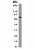 Western blot of human human stomach lysate using CEA antibody (SPM584) .