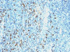 Formalin-fixed, paraffin-embedded human tonsil stained with anti-Lambda antibody (SPM559) .
