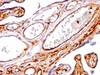 Formalin-fixed, paraffin-embedded human placenta stained with Moesin antibody (SPM562)