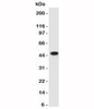 Western blot of HeLa lysate using CK17 antibody (SPM560) .