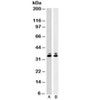 Western blot testing of A) human HeLa and B) mouse NIH3T3 cell lysates with anti-PCNA antibody (clone SPM350) . Predicted molecular weight ~29kDa, routinely observed at 29~36kDa.