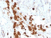 IHC testing of FFPE human pituitary gland with anti-ACTH antibody (clone SPM333) .