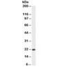 Western blot testing of HeLa cell lysate with anti-Bax antibody (clone SPM336) . Observed molecular weight ~21kDa.