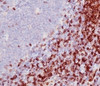 Formalin-fixed, paraffin-embedded human tonsil stained with anti-CD5 antibody (SPM546)