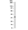 Western blot testing of Ramos cell lysate with anti-CD74 antibody (clone SPM523) . Predicted molecular weight ~33kDa.