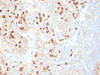Formalin-fixed, paraffin-embedded human tonsil stained with Plasma cell Marker antibody (SPM310) .