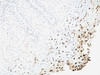 Formalin-fixed, paraffin-embedded human cervix stained with anti-L1 antibody (SPM257)