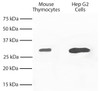 Total cell lysates from mouse thymocytes and Hep G2 cells were resolved by electrophoresis, transferred to PVDF membrane, and probed with Mouse Anti-Bcl-xL-UNLB (Cat. No. 99-620) . Proteins were visualized using Goat Anti-Mouse IgG2a, Human ads-HRP secondary antibody and chemiluminescent detection.