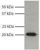 Total cell lysates from HL60 cells were resolved by electrophoresis, transferred to PVDF membrane, and probed with Mouse Anti-Human Bax-UNLB (Cat. No. 99-622) . Proteins were visualized using Goat Anti-Mouse IgG1, Human ads-HRP secondary antibody and chemiluminescent detection.