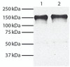 Total cell lysates from HEp-2 (Lane 1) and MIA PaCa-2 (Lane 2) cells were resolved by electrophoresis, transferred to PVDF membrane, and probed with Mouse Anti-Human EGFR-UNLB (Cat. No. 99-728) . Proteins were visualized using Goat Anti-Mouse IgG, Human ads-HRP secondary antibody and chemiluminescent detection.