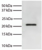 Total cell lysates from Jurkat cells were resolved by electrophoresis, transferred to PVDF membrane, and probed with Mouse Anti-Human Bid-UNLB (Cat. No. 99-753) . Proteins were visualized using Goat Anti-Mouse IgG, Human ads-HRP secondary antibody and chemiluminescent detection.