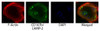 Osteoclasts from ashen mice were stained with AF594 conjugated phalloidin and Rat Anti-Mouse CD107b-UNLB (Cat. No. 99-112) followed by a secondary antibody and DAPI. 

Images from Shimada-Sugawara M, Sakai E, Okamoto K, Fukuda M, Izumi T, Yoshida N, et al. Rab27A regulates transport of cell surface receptors modulating multinucleation and lysosome-related organelles in osteoclasts. Sci Rep. 2015;5:9620. Figure 6 (a)