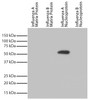 Recombinant influenza proteins were resolved by electrophoresis, transferred to PVDF membrane, and probed with Mouse Anti-Influenza A, Nucleoprotein-UNLB (Cat. No. 99-734) . Proteins were visualized using Goat Anti-Mouse IgG, Human ads-HRP and with chemiluminescent detection.